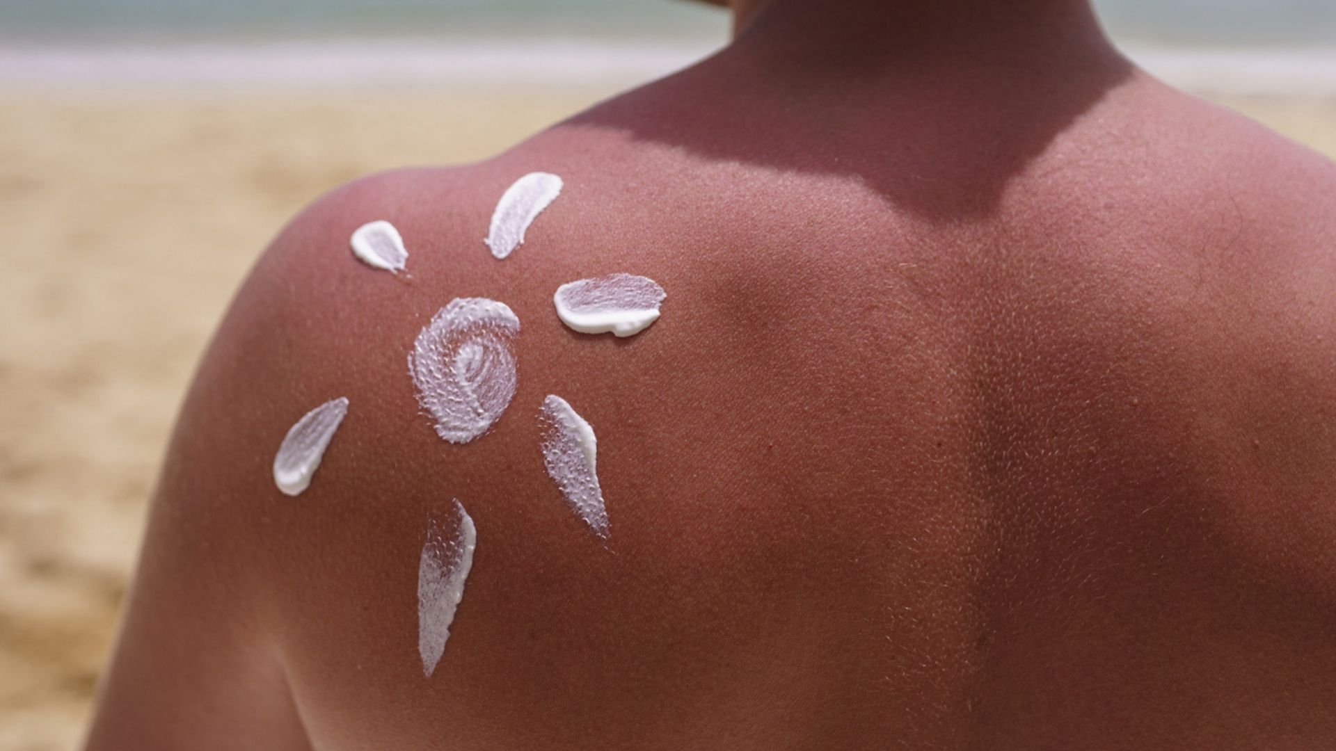 Pessoa passando protetor solar mineral nas costas na praia.