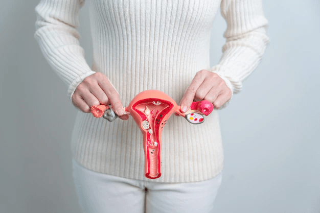 Endometriose | Crédito: Divulgação