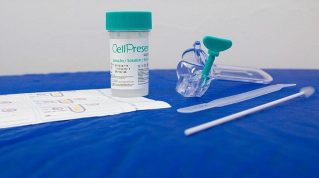 Exame inovador para detectar câncer do colo do útero